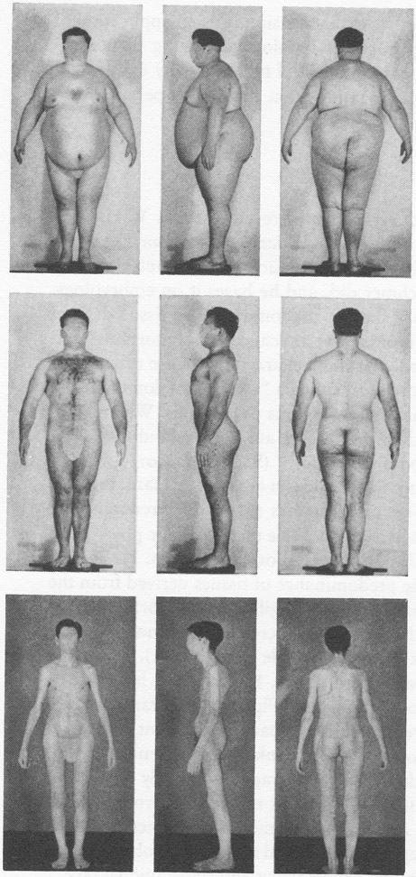 FIGURE 7 Sheldon’s endomorph (top), mesomorph (middle), and ectomorph (bottom) (Sheldon 1940, frontispiece)